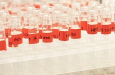 Irish athlete reportedly involved in anti-doping violation
