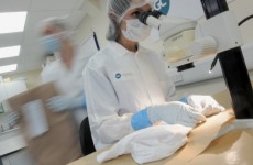 Scientists discover link between HIV drug and osteoporosis
