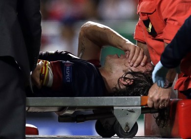 Puyol is stretchered off last night.