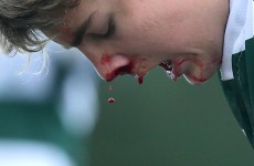 7 of the best images from the today’s schools rugby action