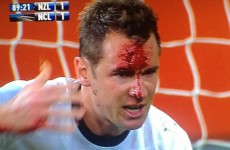 VIDEO: New Zealand’s Shane Smeltz has his head busted wide open